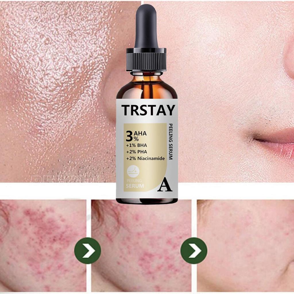 Retinol Instant Acne and Wrinkle Removing Facial Essence Lifting, Firming, Anti Aging, Whitening, Korean Care Cosmetics