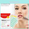 Jaysuing Cloud Acne Patches Gentle Cleansing For Reducing Acne Scars And Blemishes 144pcs