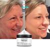 Heavy Wrinkle Correction Cream Corrects Even Skin Color Difference, Moisturizes and Nourishes the Skin. Moisturizing Cream