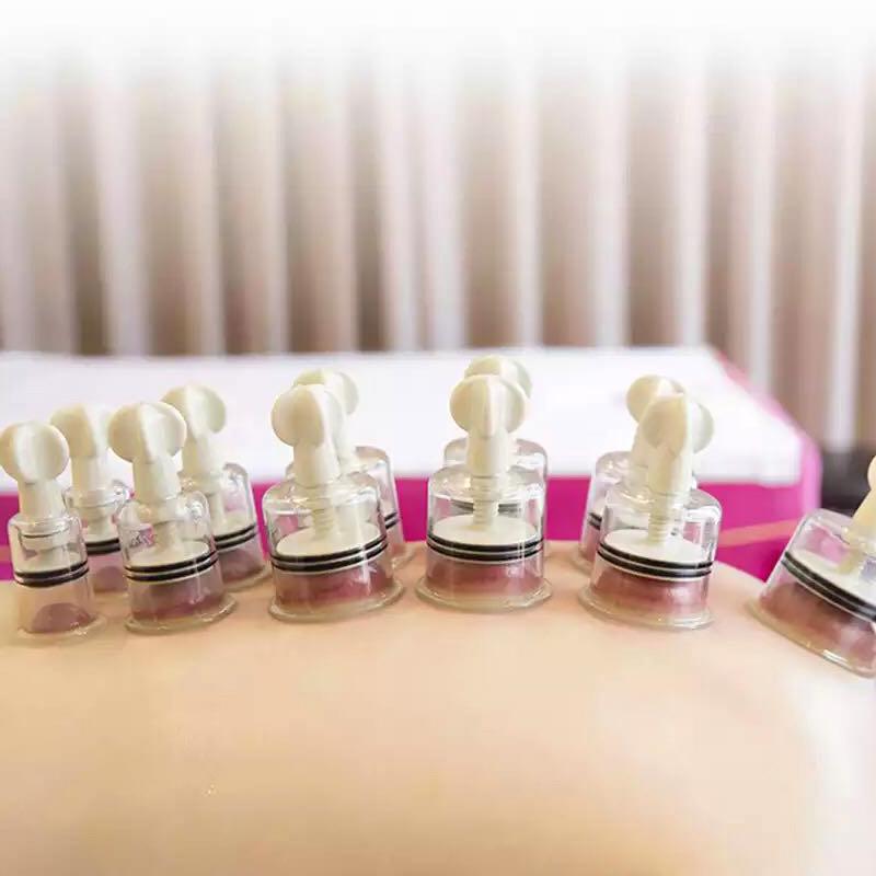 SHARE HO 5 Storlek ABS Vakuumkoppar Burkar Handvridna Anti-cellulit Massagekoppar Roterande Sugkopp Kinesisk Terapi Hälsovård