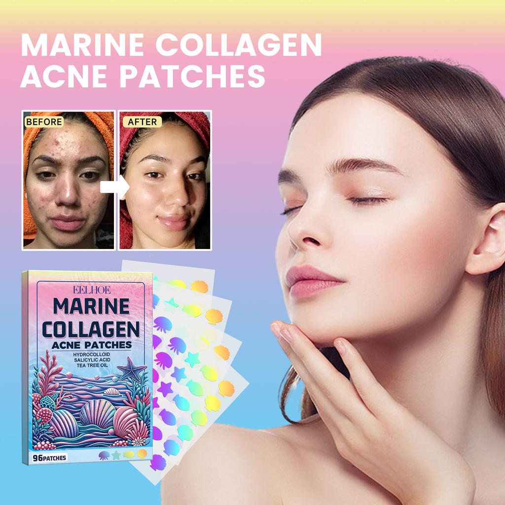 Eelhoe Cute Colorful Acne Patches Convenient Multi-shape Dots For Clear Skin Care