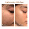 The Skin Story Brightening Face Scrub | Gentle Exfoliation | Brightens & Detans | Removes Tan, Exfoliates & Renews Skin | 100g