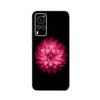 Transparent Tpu Coque Cover For Vivo X60 Pro Case High Quality Luxury Silicone Soft Phone Case For Vivo X60 4G 5G X60T X 60 Case