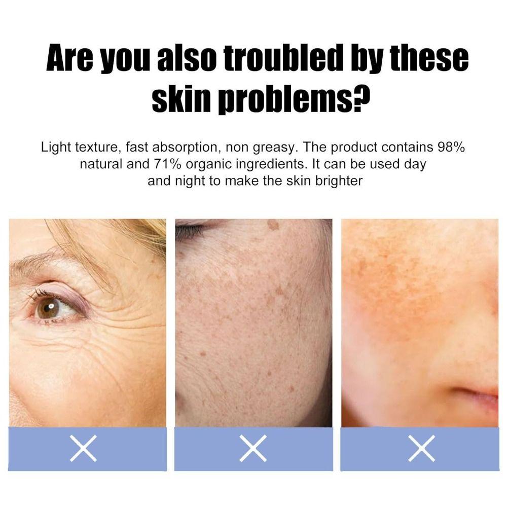 100ml Freckle Removal 377 Essence Oil Long-lasting Face Oil  For Face & Body