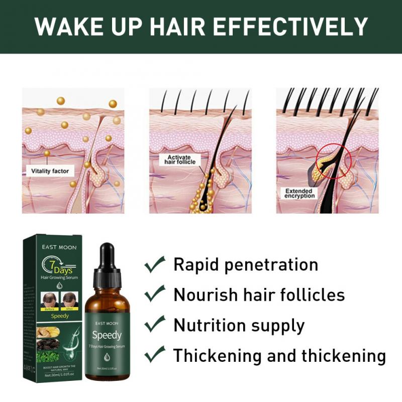 7-Day Hair Growth Serum - Nourishing Essential Oil for Scalp & Hairline Hydration