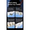 Dental calculus removal tool, ultrasonic scaler, tooth whitening device, electric tooth washer