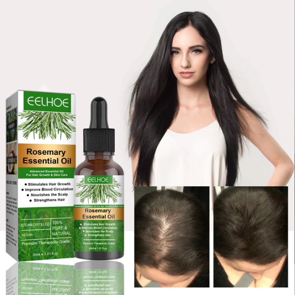 EELHOE 30ml Rosmarin-Haarwuchsöl, ätherisches Öl, verhindert Haarausfall, nährt die Kopfhaut und stärkt das Haar