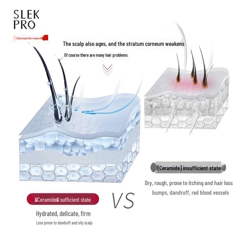 Sleek Head Refreshing Anti-Dandruff Shampoo