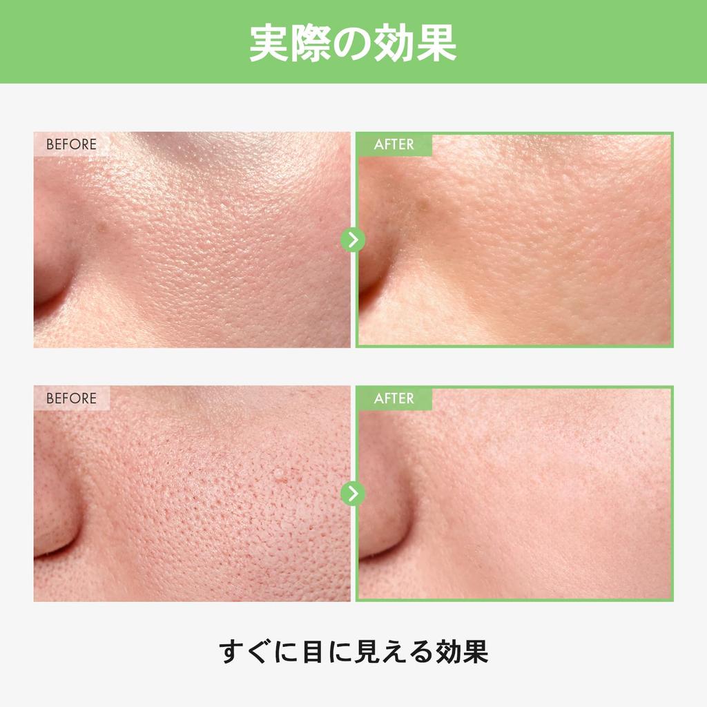 TOSOWOONG Green Tomato Pore Ampoule Pore Dry Oil and Moisture Rough Korean Skincare Cosmetics 30ml, Care, Niacinamide, Squalane, Ceramide, Tightening,