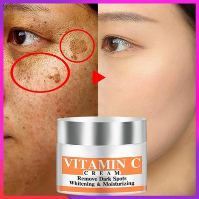 Newest Vitamin C Whitening Facial Cream Repair Fade Freckles Remove Dark Spots Melanin Remover Brightening Face Cream