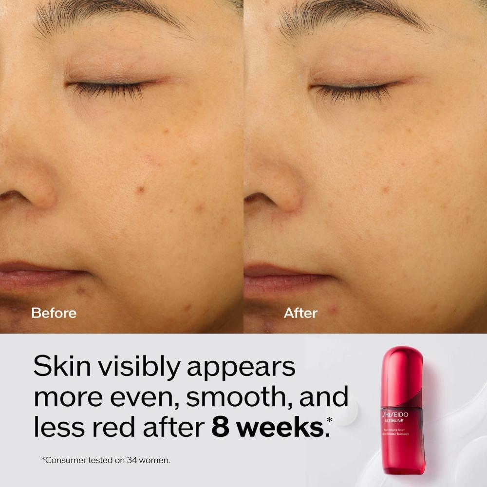 Shiseido Ultimune Power Infusing Serum 2.5 Oz For Radiance   Wrinkles