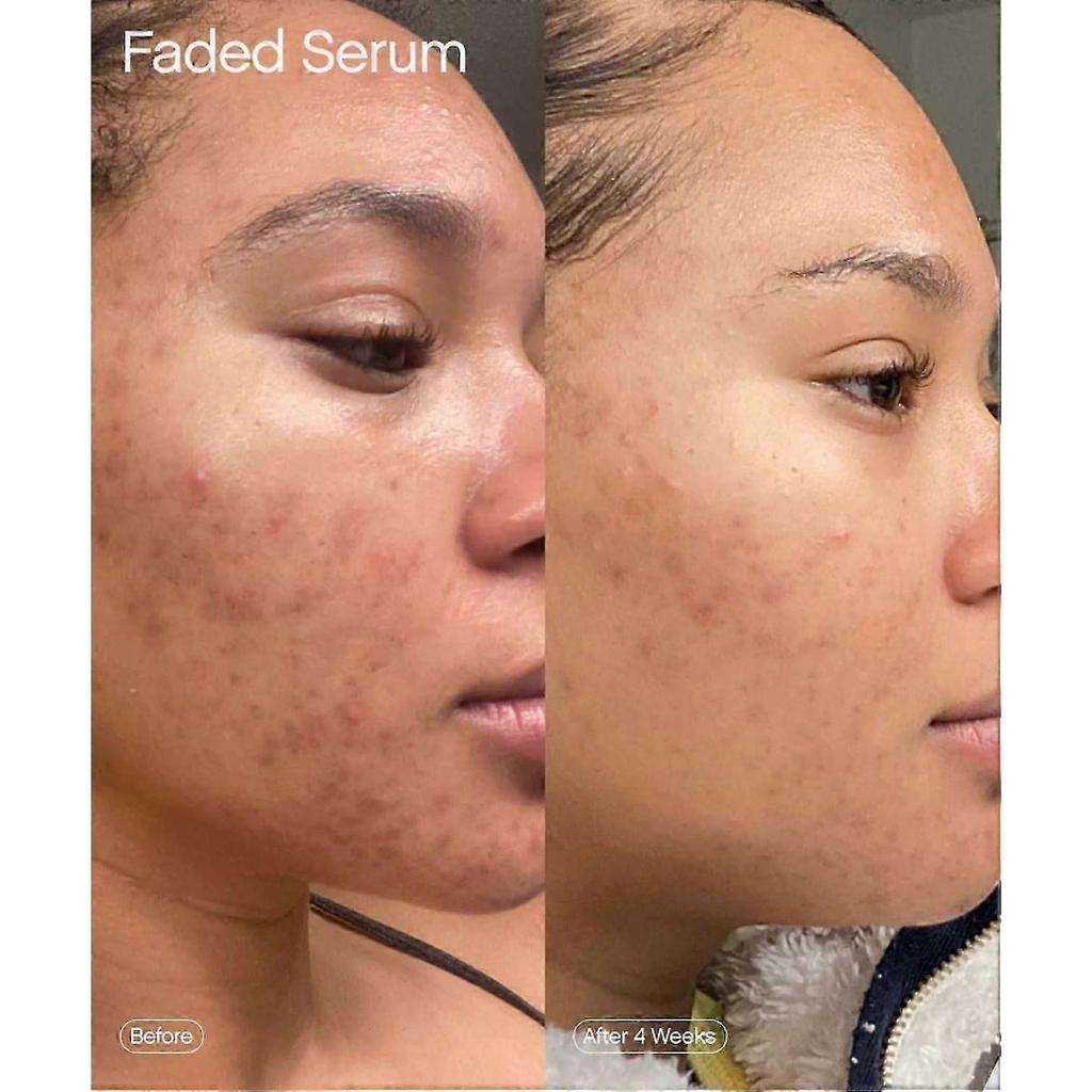 Brighten Face Serum, Smooth Nourishment Improves Skin Regeneration, Fades Fine Lines Anti-Aging Repair Serum