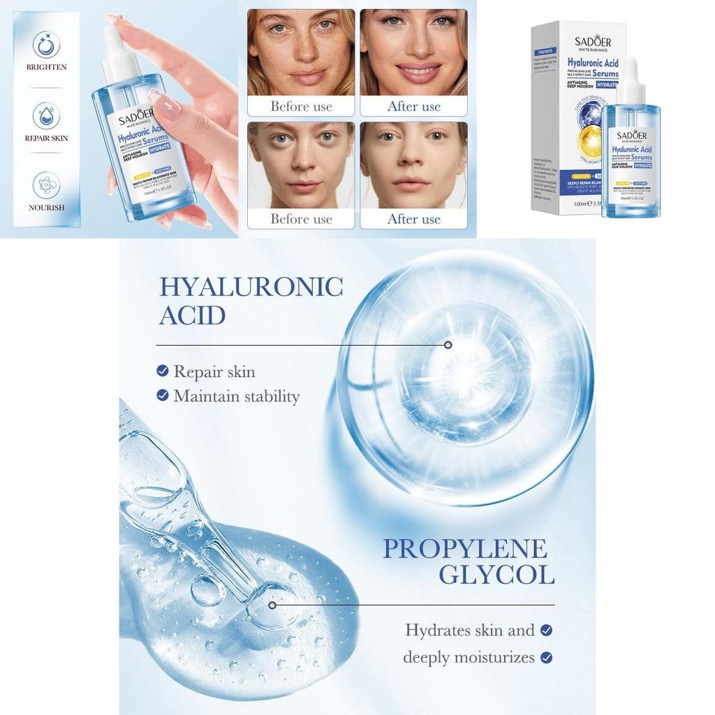 Sadoer Hyaluronic Acid Essence 100ml Ultra Hydrating And Pore Minimizing Serum For All Skin Types