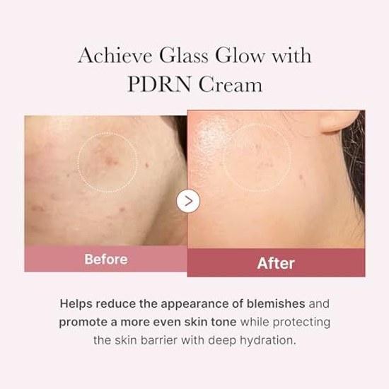 Medikube PDRN Pink Moisture Cream