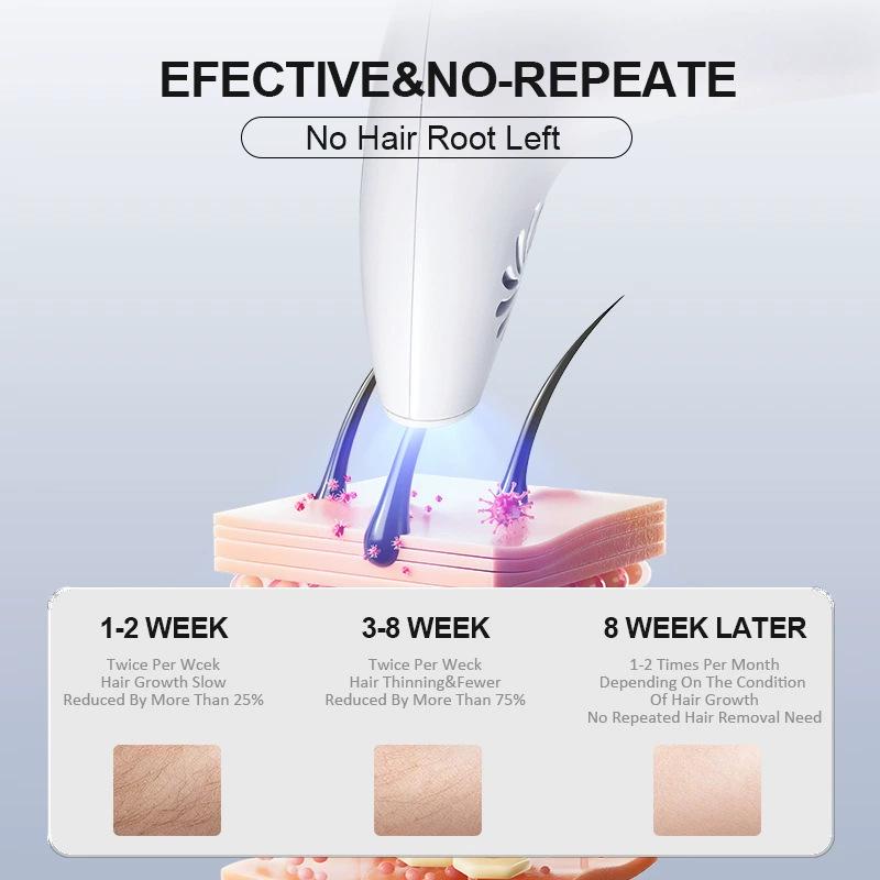 Portable IPL Laser Hair Removal Device for Whole Body and Underarms