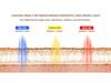 Seven-Color Folding LED Spectrometer for Photodynamic Skin Rejuvenation