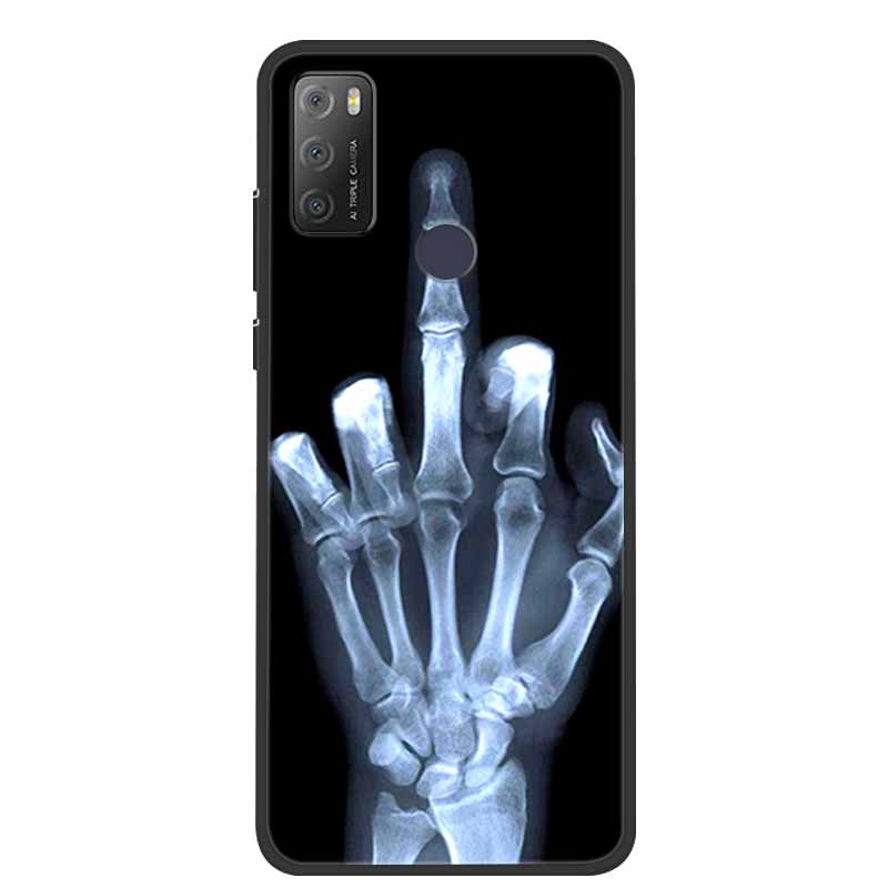 Pro Alcatel 1S 2021 Case Luxusní silikonový TPU měkký kryt na telefon pro Alcatel 1S 2020 Nárazuvzdorný roztomilý TPU nárazník Fundas Coque