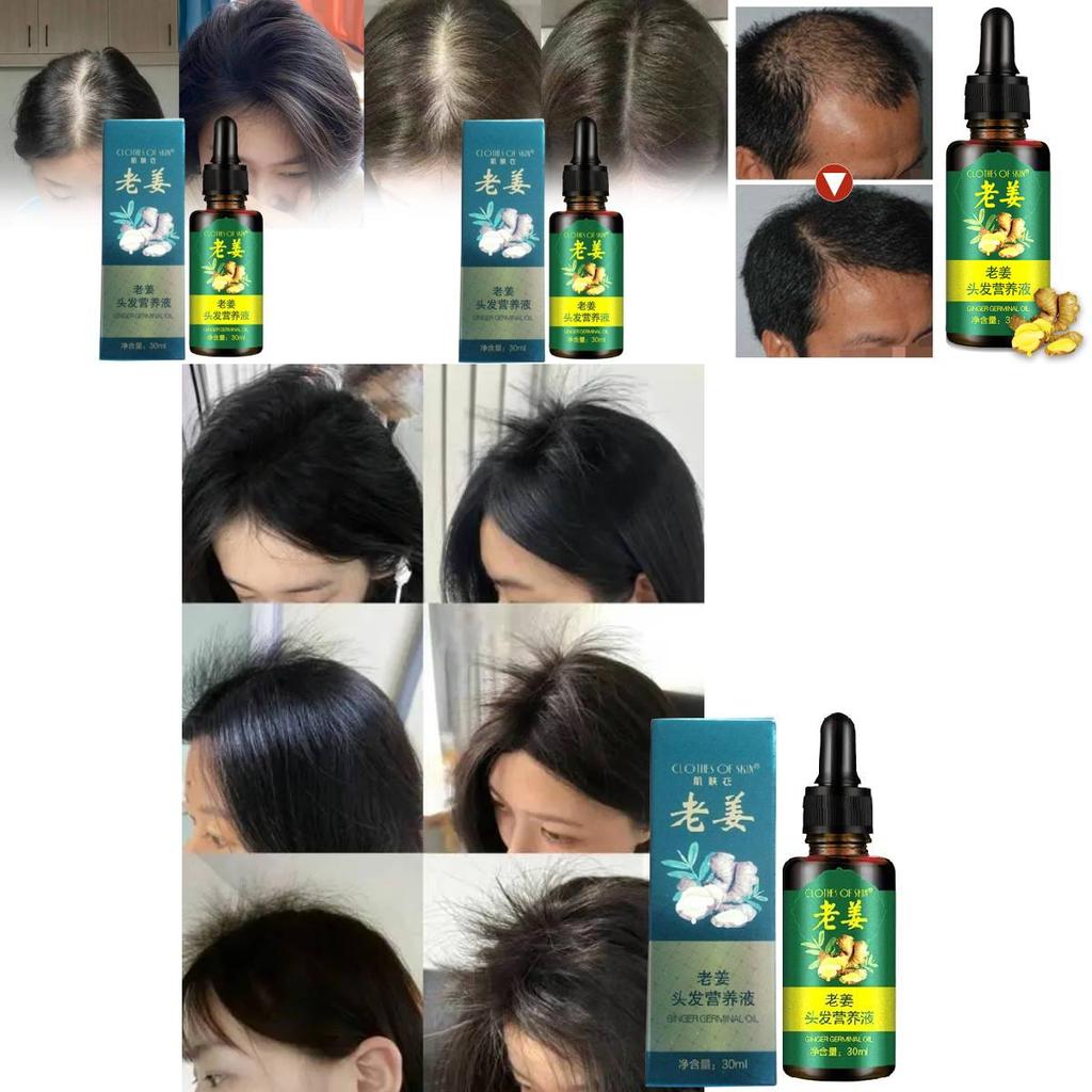 Nourishing Ginger Hair Essence For Healthy And Shiny Locks With Oil Control Benefits