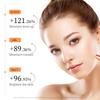 Moika Whitening Freckle Removing Essence Skin Tone Serum Fade Acne Mark Brightaening Beauty Skin Care Products 30Ml