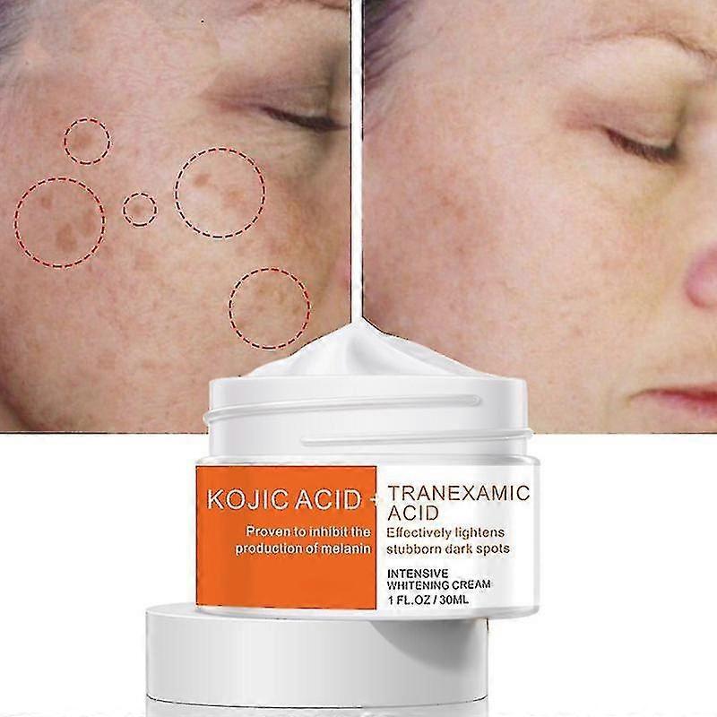 Intensive Whitening Cream Kojic Acid Tranexamic Acid Cream Inhibit The Production Of Melanin Lightens Stubborn Dark Spots Cream