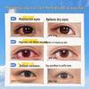 Ruyi Lutein Eye Relief Spray