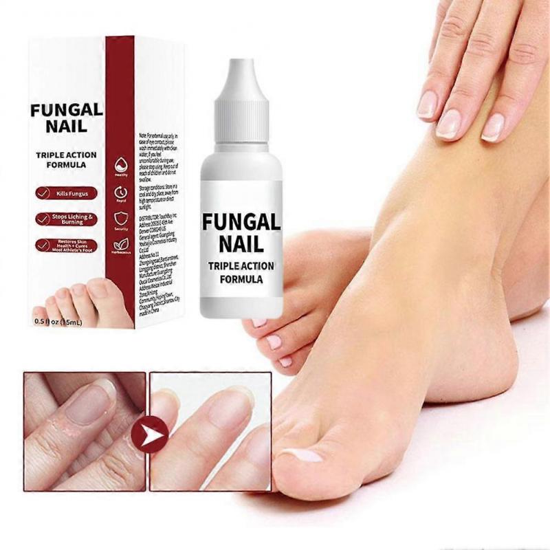 Nail Repair Solution 15ml Deep Nourishing Cuticle Treatment For Strong Glossy Nails Fast Absorbing Non Sticky Portable Care