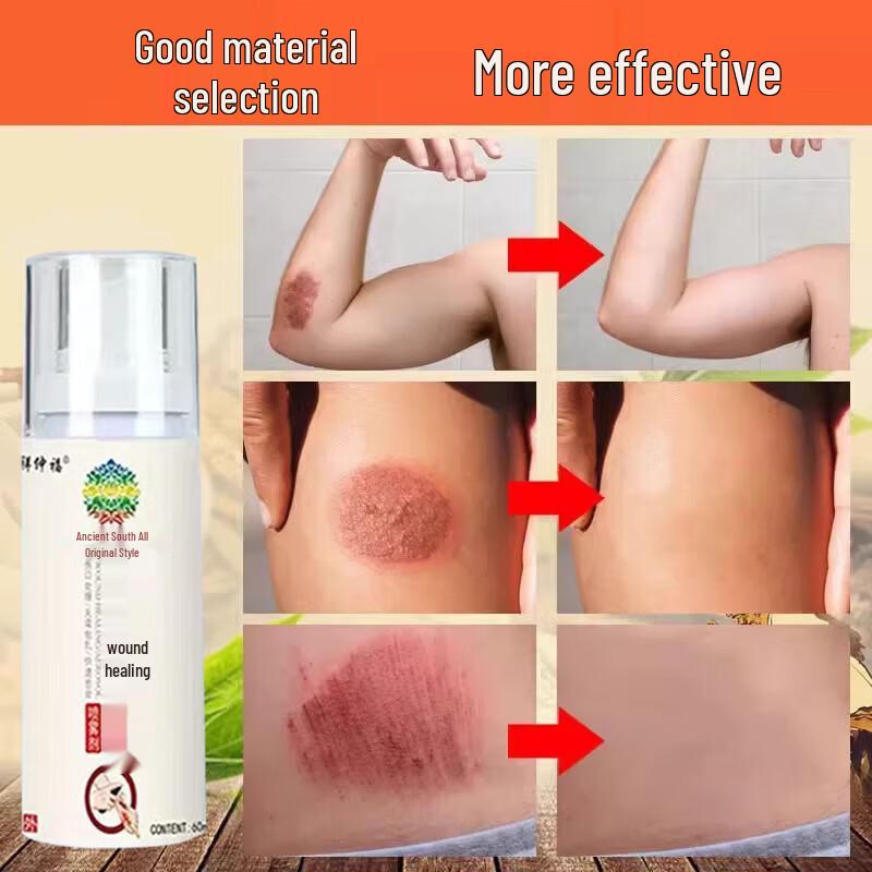 Nuobiyan Wound Healing Spray