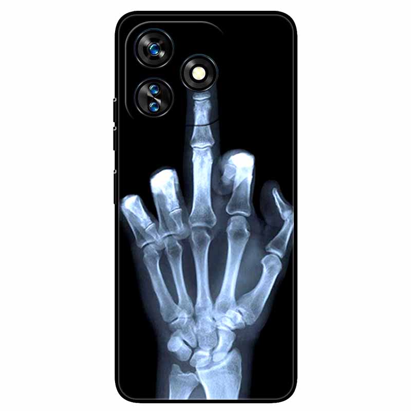 For Oukitel C51 Case 6.8'' Shockproof Silicon Animals Cool Painted Covers for Oukitel C51 C 51 Cartoon TPU Shell Protective Capa