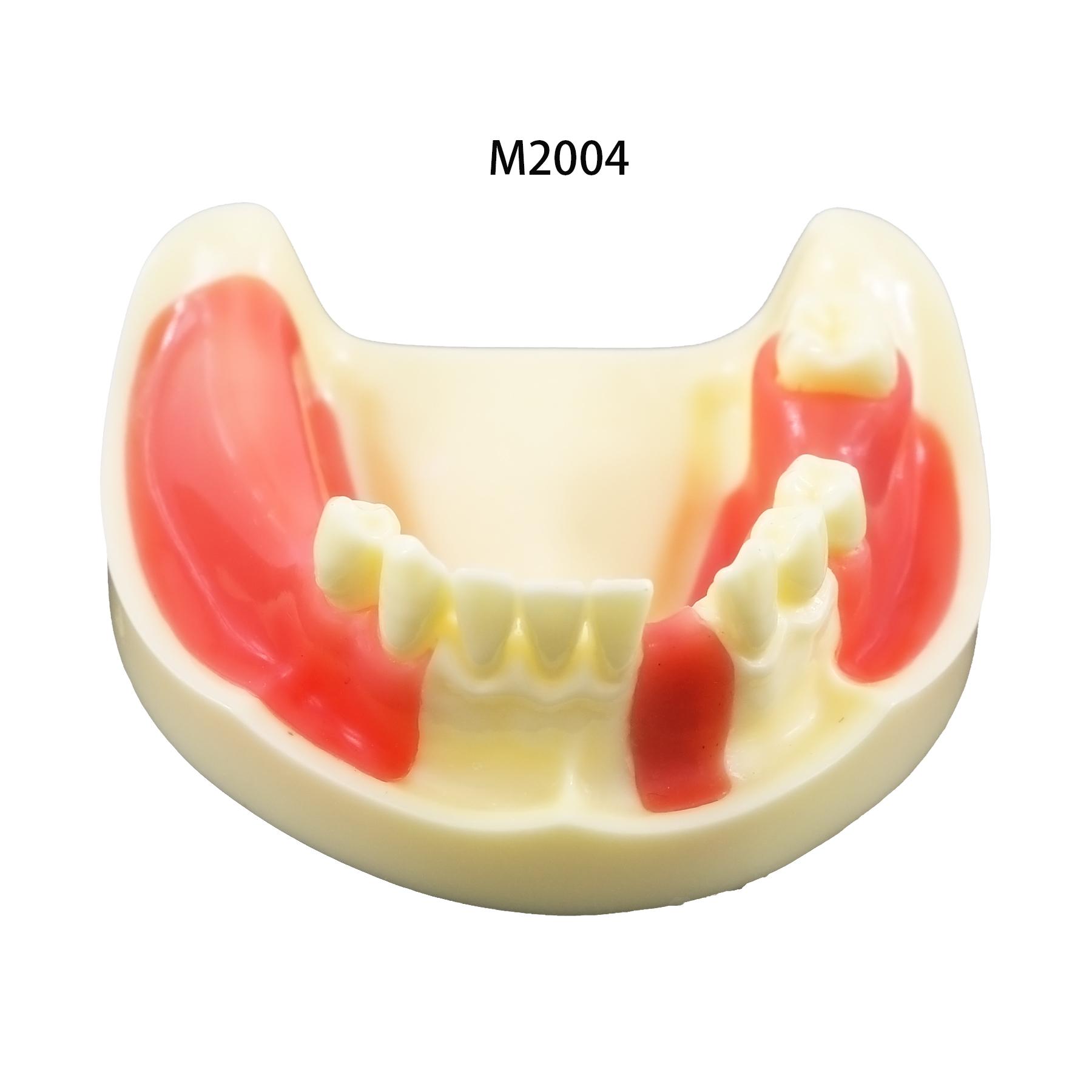Dental Model Dentistry Implant Practice Training Model For Cutting Implant And Suturing Practice with Cancellous Bone Dental Lab M2004