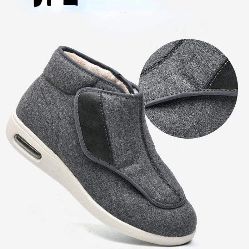 Winter Velvet Orthopedics Wide Feet Swollen Shoes  Eversion Adjusting Soft Comfortable Diabetic Shoes Dad Walking Shoes