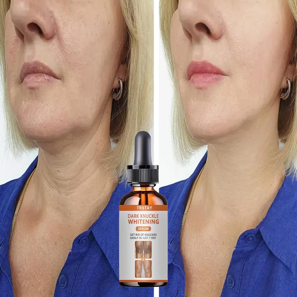 Collagen Complex Serum Face Blemish Skin Repair Essence Hydratační bělící zpevňující Zlepšení pružnosti obličeje Péče o pleť Ženy
