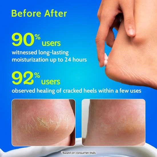 Crema de Pies Chemist at Play para Talones Agrietados y Pie Diabético | Hasta 24 horas de Hidratación | 10% Urea y AHAs Naturales | Hidratación | 50g