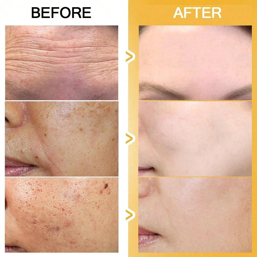 Anti Wrinkle Face Cream, Firming Skin, Whitening and Brightening, Anti-oxidation, Anti-aging Moisturizing Cream