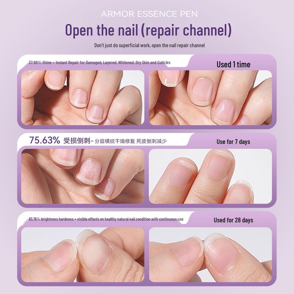3-in-1 Nail Art Pen: Cuticle Remover, Nail Bed Repair, and Edge Oil for Anti-Breakage and Damaged Nail Care.