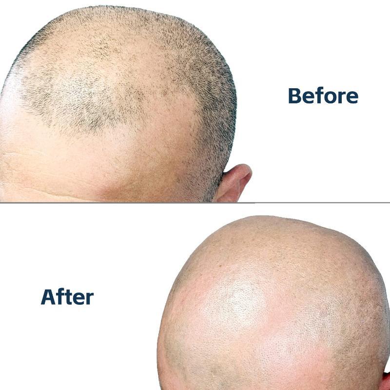 Men'S Convenient Multi-Blade Shaver Effortless Bald Head & Body Hair Grooming For Unisex Washable Shave Clean In One Strok