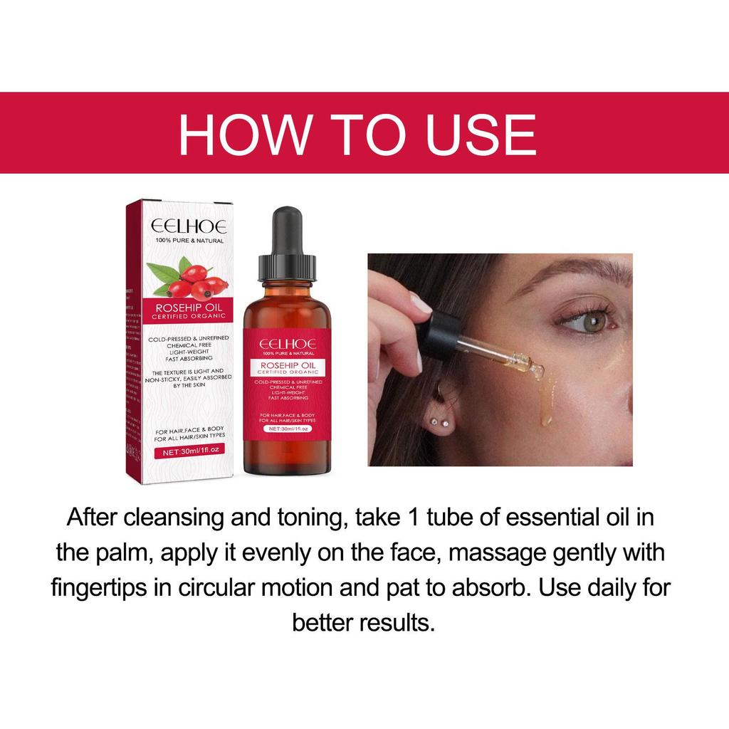 EELHOE Rosehip Oil 30ml: Reduces fine lines, brightens and whitens, fades dark spots, deeply moisturizes, and softens hair. A skin and hair care oil.