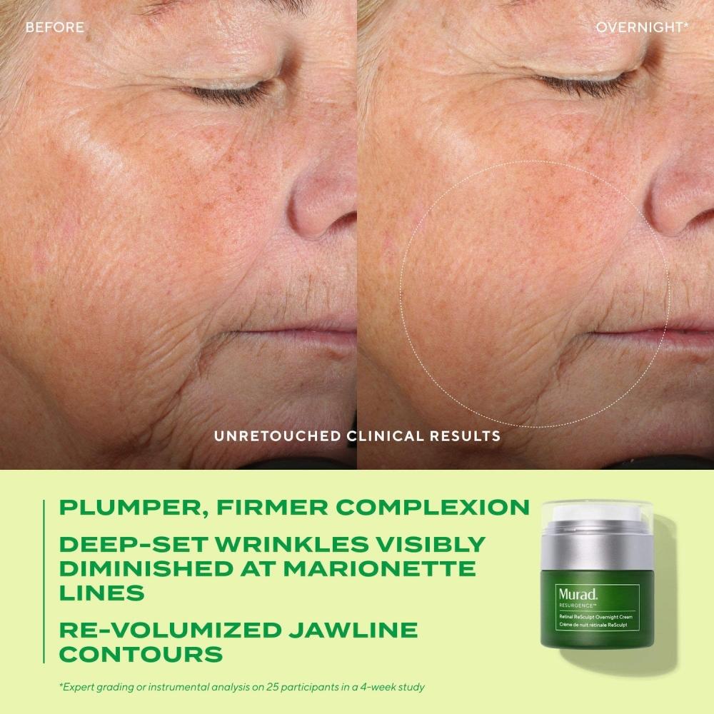 Murad Retinal Resculpt Overnight Cream 1.7 Oz 50 Ml