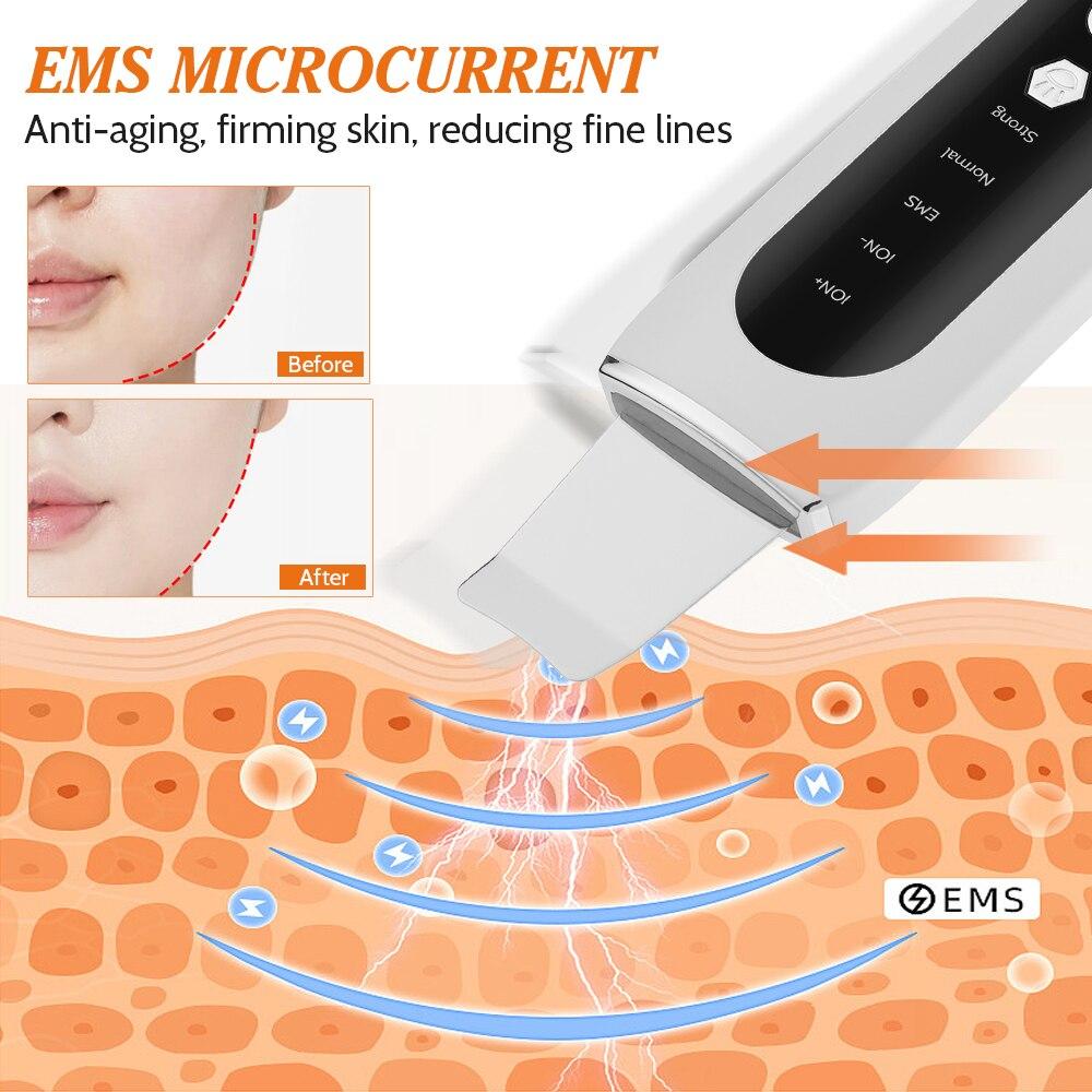 Ultrasonic Skin Scrubber EMS Peeling Blackhead Remover Deep Face Cleaning Ultrasonic Ion Acne Pore Cleaner Face Shovel Cleanser