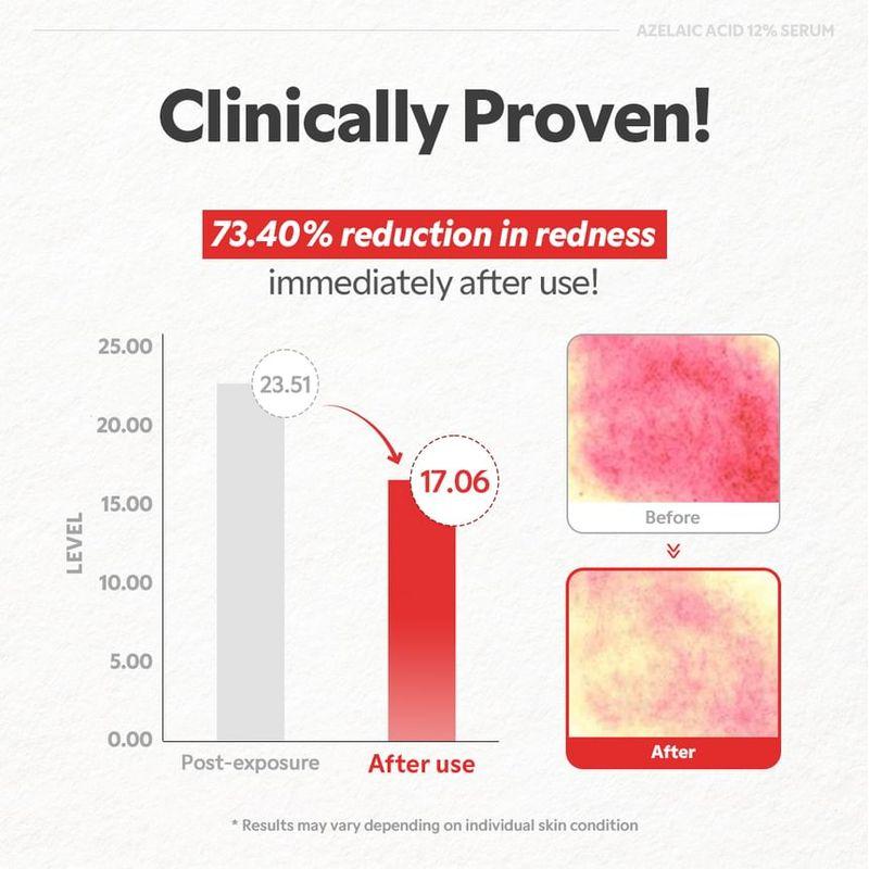 TIRTIR - Azelaic Acid 12% Serum