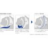 General medical device for preventing snoring: Nastent Classic (Right 145mm Soft)
