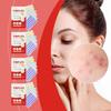 Heart Star Flower Round Pimple Patch for  Spot  Hydrocolloid 240pcs for Blemish Concealing Facial Care