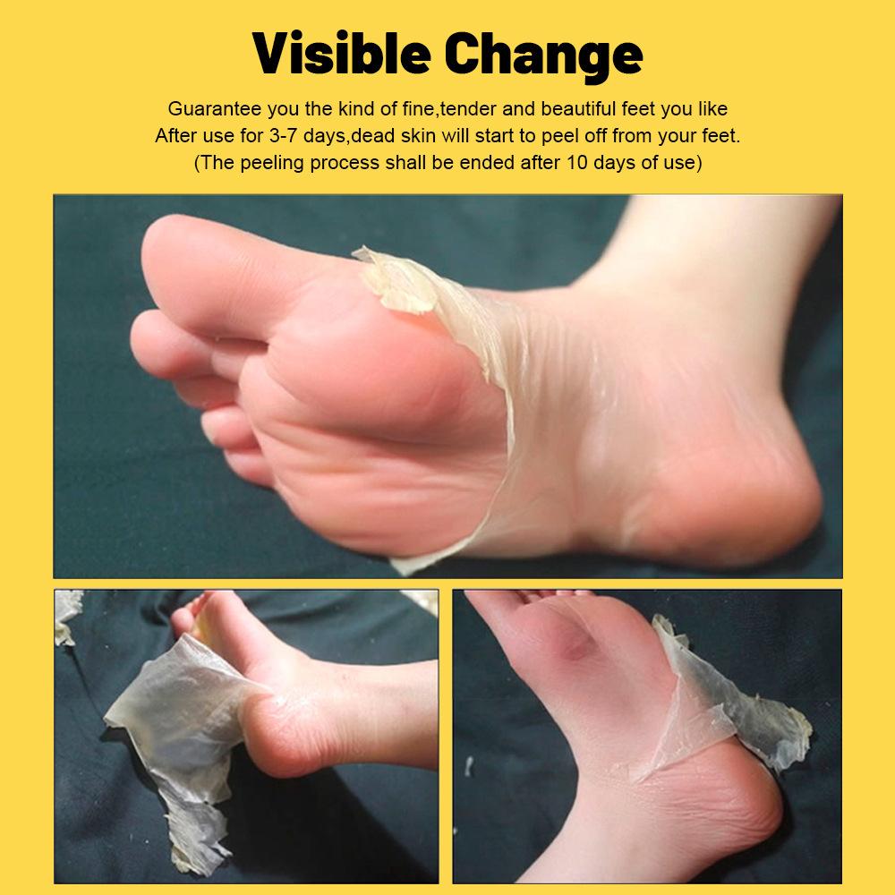 AICHUN Banana Peeled Foot Mask for Hydrating, Brightening, Exfoliating and Foot Care