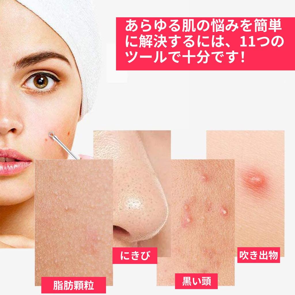 Doyime Precision Tweezers for Blackheads of with Universal Tweezers for Hair Acne Nose Pore Stainless Includes Storage Silver (Set 8) 0.1mm Tips,