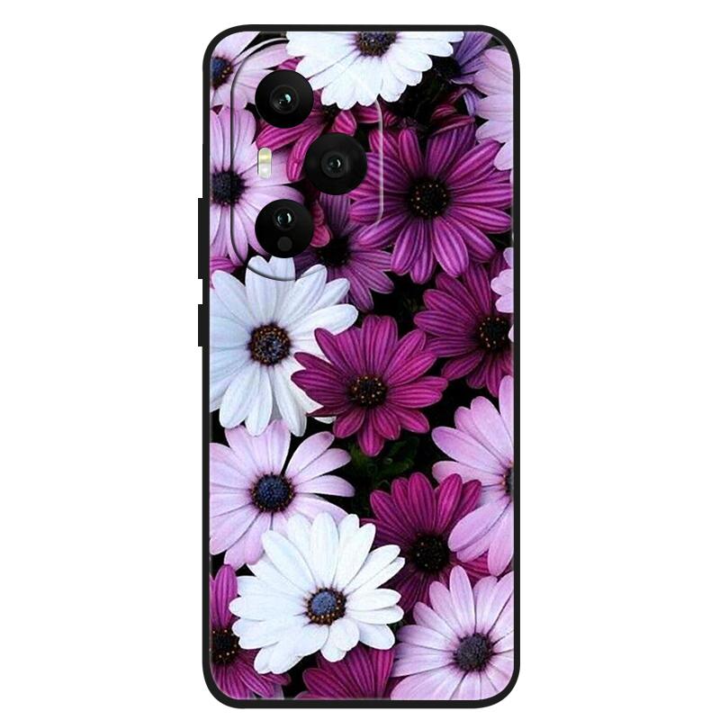 For Honor 400 Pro Case Silicone Luxury Space Soft Bumper for Honor 400 Pro Phone Cover Honor400 5G Global Version TPU Funda 2025