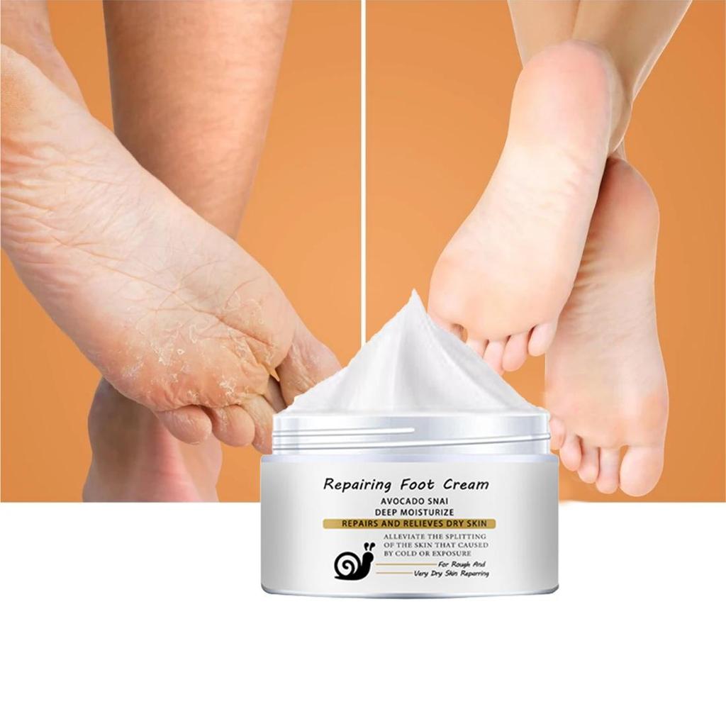 Repair Foot Cream for Chapped, Broken Hands/heels, Natural Essence Cream, Gentle and Non-irritating