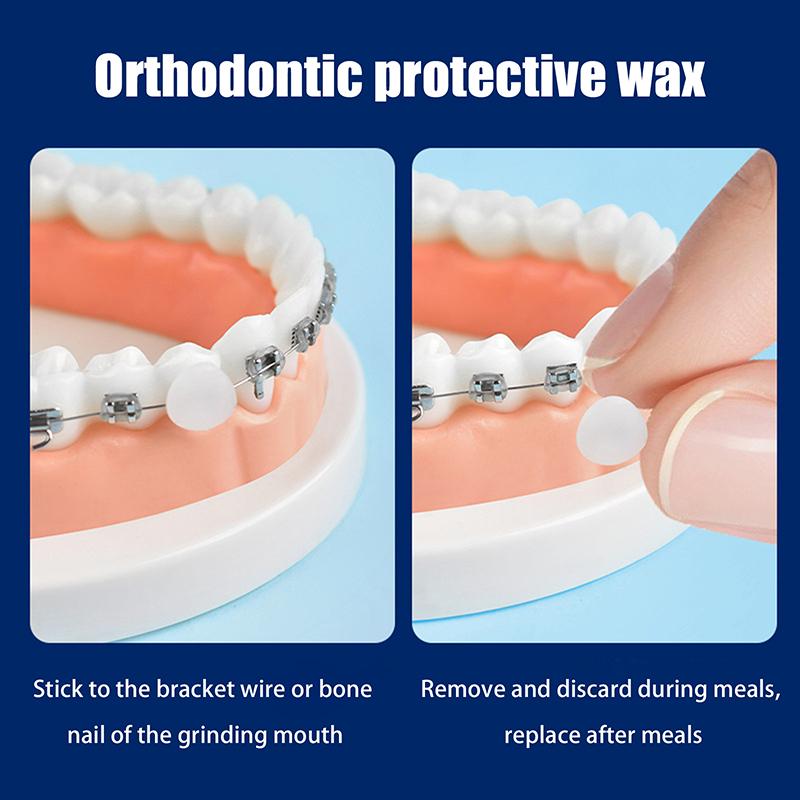 35Pcs Dental Orthodontic Wax For Braces Orthodontic Anti-Grinding Food Grade Denture Wax Individually Packaged Superior Hygiene