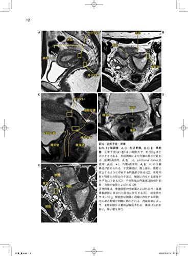 Imaging Diagnosis of Gynecological Diseases Learned from Case Studies