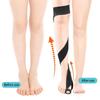 O/X Leg Type Correction Belt,Knock Knees Valgus Deformity Bows Legs Bands Straighten Belt,Legs Postures Corrector Belt