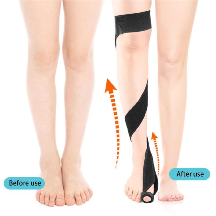 O/X Leg Type Correction Belt,Knock Knees Valgus Deformity Bows Legs Bands Straighten Belt,Legs Postures Corrector Belt