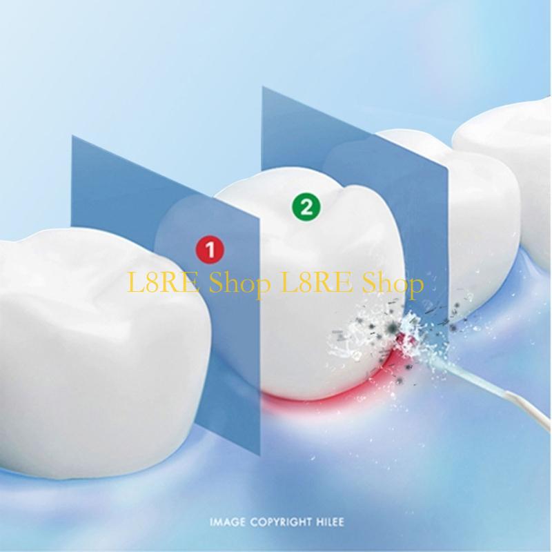 L8RE Ball Added at the End of Tube Water Flosser